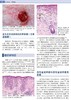 麦基皮肤病理学——与临床的联系（第4版） 北医社 孙建方 高天文 涂平 主译  朱学骏主审 商品缩略图6