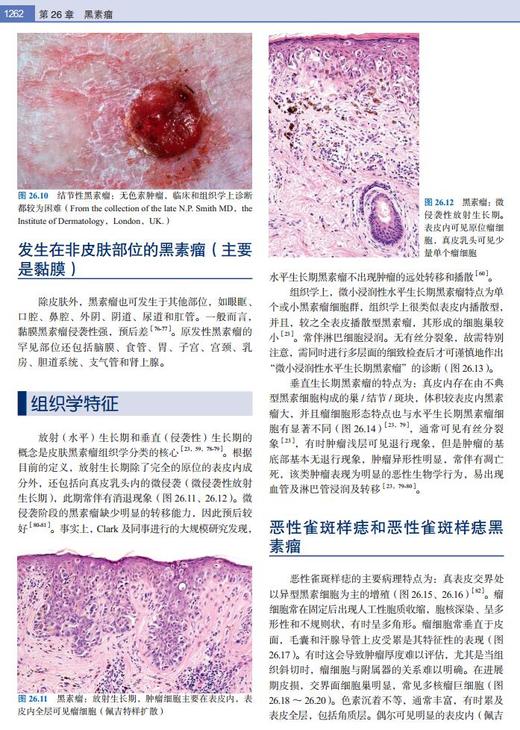 麦基皮肤病理学——与临床的联系（第4版） 北医社 孙建方 高天文 涂平 主译  朱学骏主审 商品图6