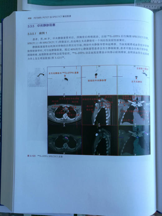 PET/MRI，PET/CT及SPECT/CT解剖图谱-☆ 商品图10