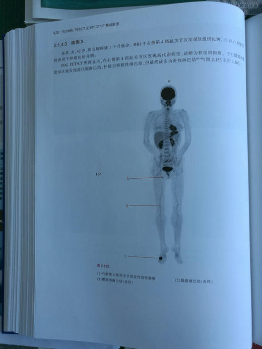 PET/MRI，PET/CT及SPECT/CT解剖图谱-☆ 商品图6