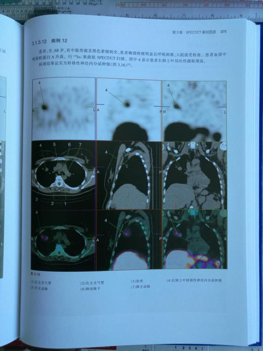 PET/MRI，PET/CT及SPECT/CT解剖图谱-☆ 商品图8