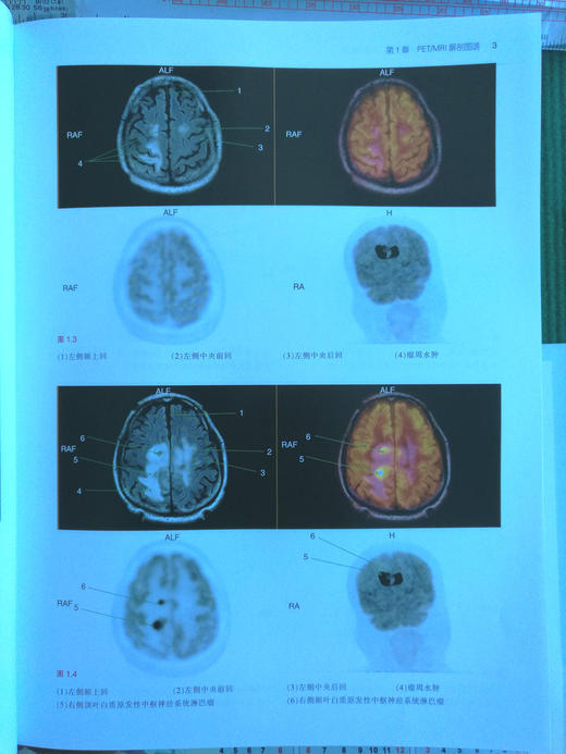 PET/MRI，PET/CT及SPECT/CT解剖图谱-☆ 商品图2