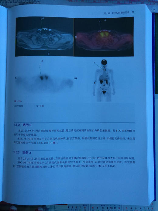 PET/MRI，PET/CT及SPECT/CT解剖图谱-☆ 商品图4