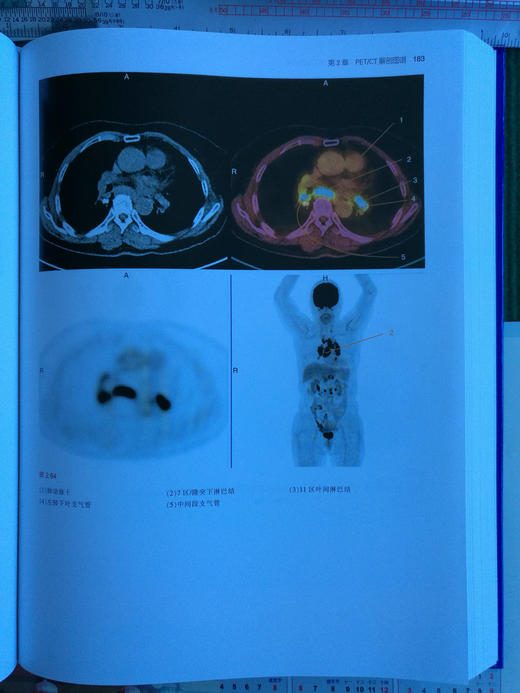 PET/MRI，PET/CT及SPECT/CT解剖图谱-☆ 商品图5