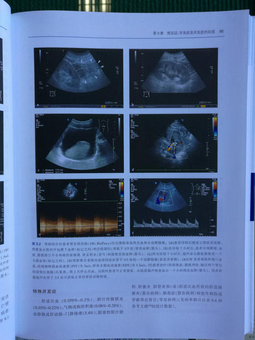 介入性超声实践指南和图谱 商品图6