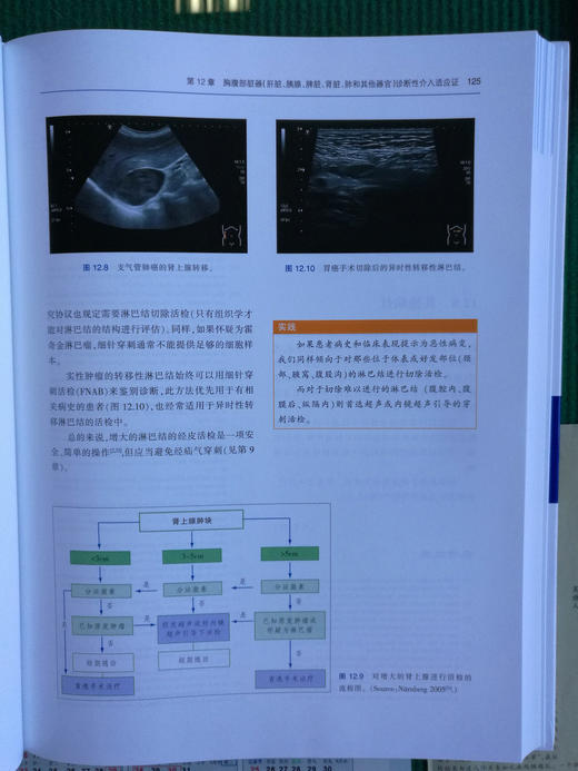 介入性超声实践指南和图谱 商品图7