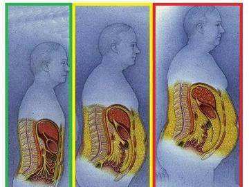 内脏脂肪和皮下脂肪图图片