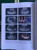 介入性超声实践指南和图谱 商品缩略图12
