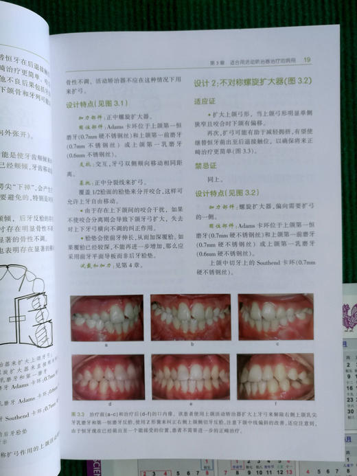 正畸保持器和活动矫治器：临床设计与应用原则
 牙体牙髓病学临床案例诊治教程  商品图4