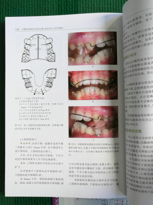 正畸保持器和活动矫治器：临床设计与应用原则
 牙体牙髓病学临床案例诊治教程  商品图12