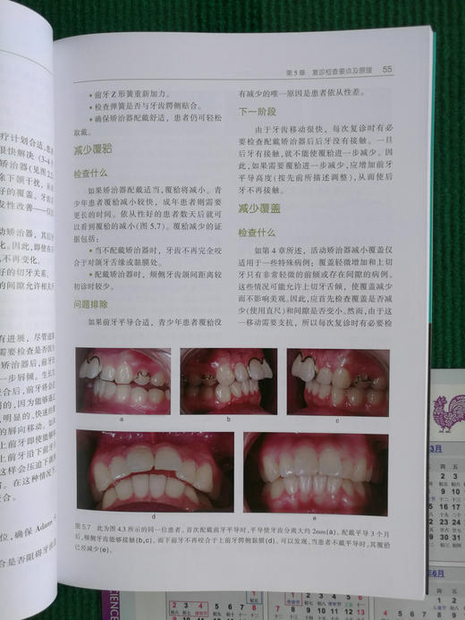 正畸保持器和活动矫治器：临床设计与应用原则
 牙体牙髓病学临床案例诊治教程  商品图6