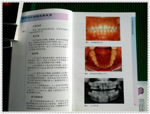 袖珍诊疗彩色图谱系列 商品图6