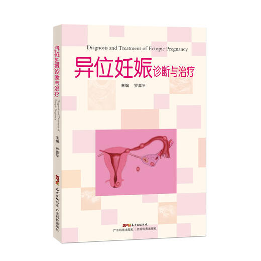异位妊娠诊治 商品图0