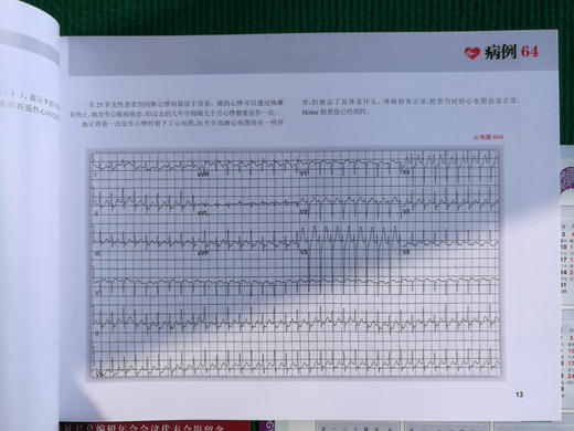 波德瑞德（Podrid）临床心电图解析（卷5B）：窄和宽QRS波心动过速实践病例 商品图3