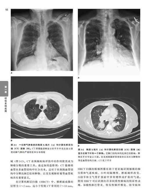 哈里森内科学——呼吸与危重症医学分册 北医社 王辰 詹庆元 主译 商品图1