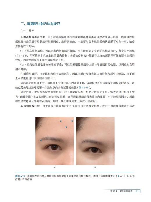 东方注射美容医学（随书赠二维码资源）北医社  崔海燕 主编 商品图4