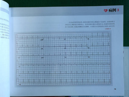 ECGs-Podrid`s Real-World (波德瑞德临床心电图解析)8本单拍 商品图2