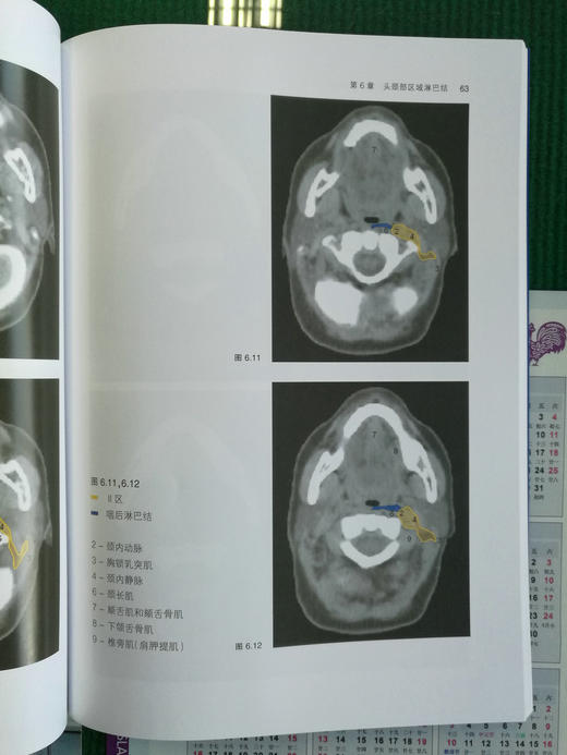 放射治*淋巴结临床靶区勾画指南 商品图6