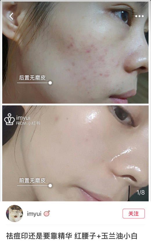 美国专柜版！Shisheido资生堂红腰子精华50ml 商品图5