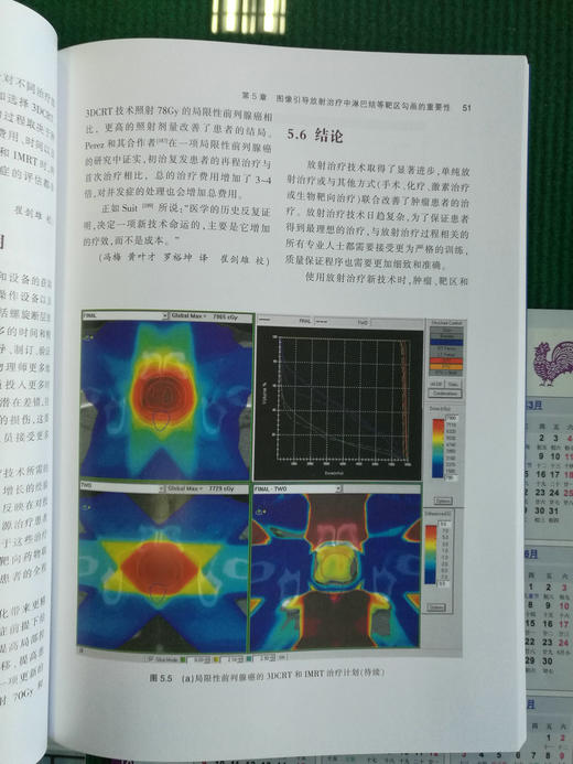 放射治*淋巴结临床靶区勾画指南 商品图5