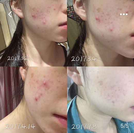 美国专柜版！Shisheido资生堂红腰子精华50ml 商品图4