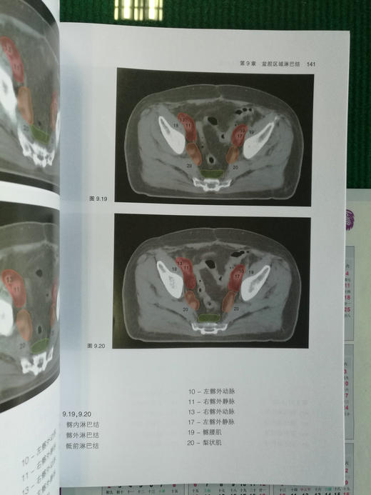 放射治*淋巴结临床靶区勾画指南 商品图9