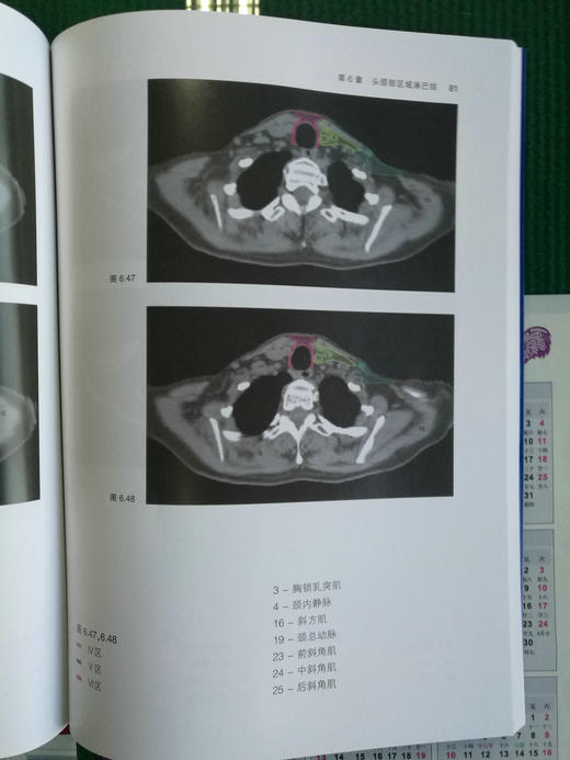 放射治*淋巴结临床靶区勾画指南 商品图7