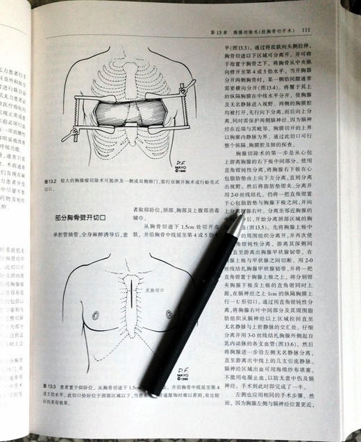 心胸外科学精要 商品图5