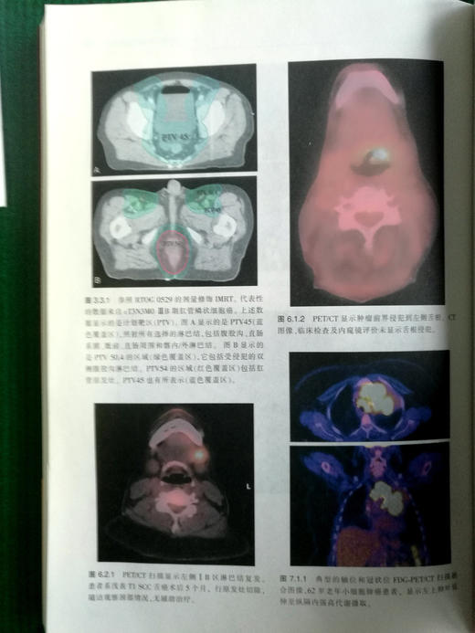 放射肿瘤学疑难病例治疗实践 商品图8