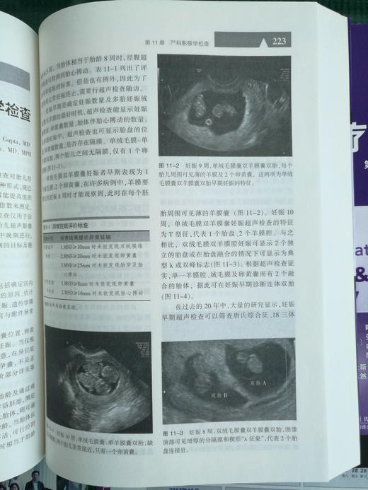 《妇产科学zuixin诊断与zhiliao》（上下册）（第11版） 商品图5