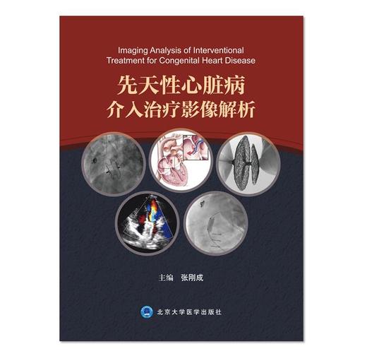 先天性心脏病介入治疗影像解析 北医社 张刚成 主编 商品图0