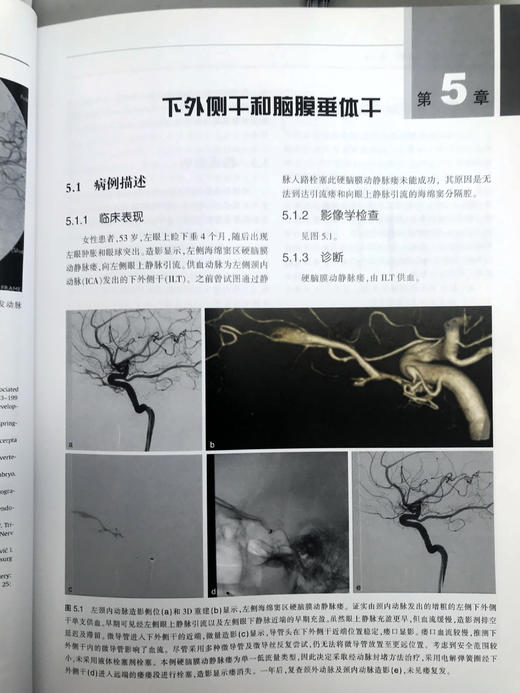 神经血管介入解剖—临床案例分析 商品图5