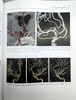神经血管介入解剖—临床案例分析 商品缩略图4