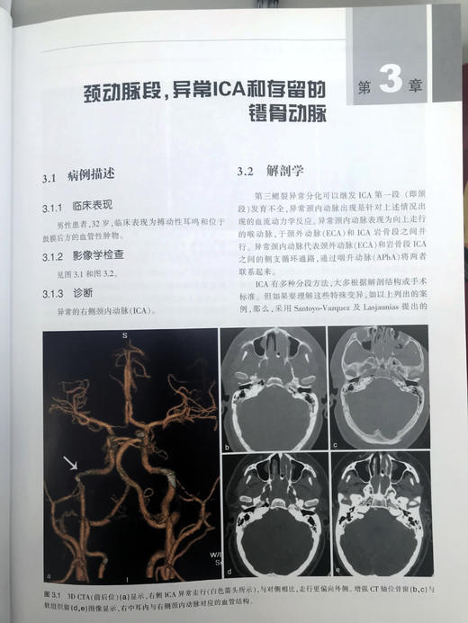 神经血管介入解剖—临床案例分析 商品图7