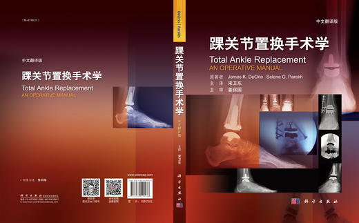 踝关节置换手术学（中文翻译版） 商品图3