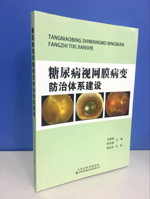 糖尿病视网膜病变fangzhi体系建设 商品图1