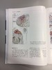 七种类型动静脉畸形 —手术策略及技巧 商品缩略图6