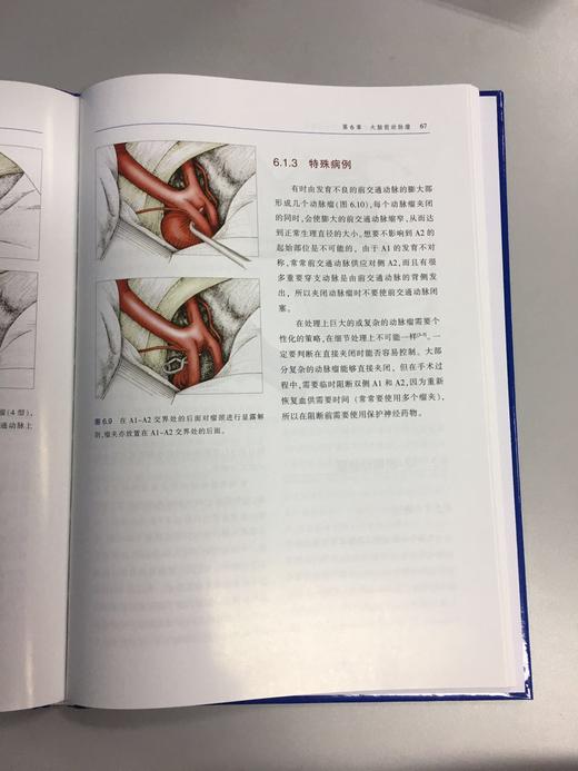 脑动脉瘤显微外科治疗：图示与病例 商品图9