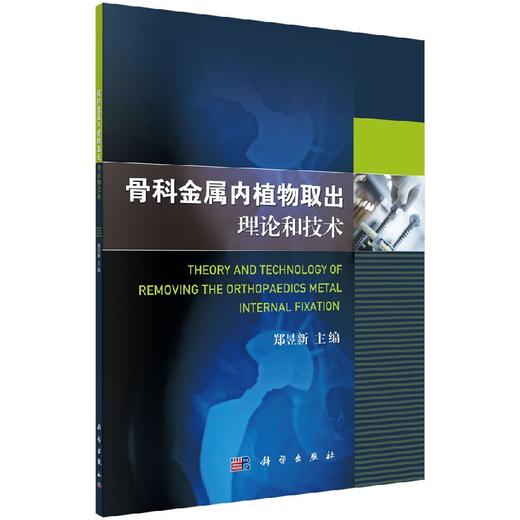 骨科金属内植物取出理论和技术 商品图0