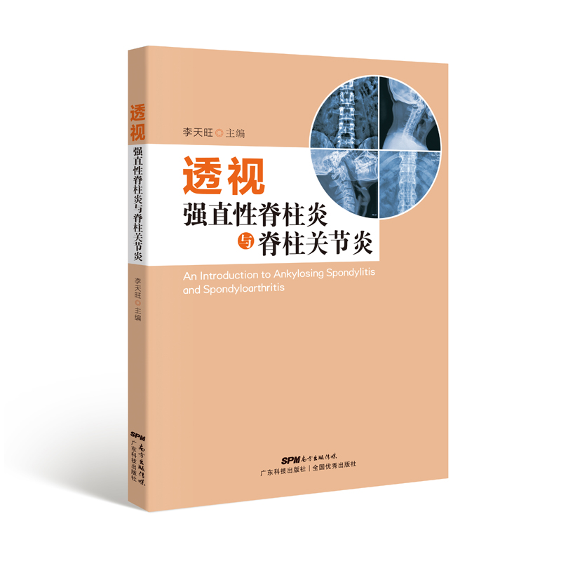 透视强直性脊柱炎与脊柱关节炎