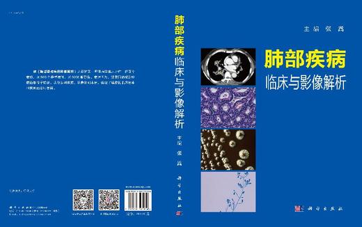 【官方首发】纵隔、肺疾病临床与影像解析肺部疾病临床与影像解析/张嵩 商品图3