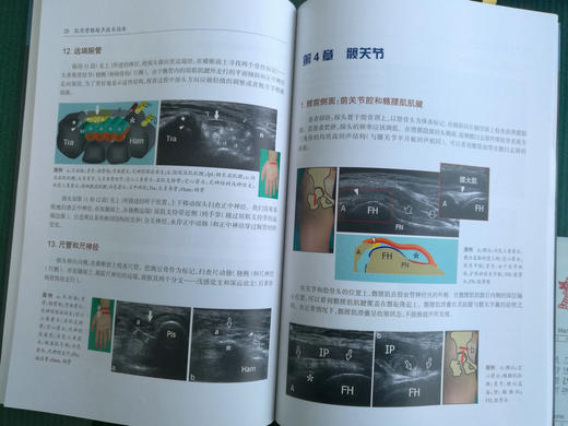 肌肉骨骼超声技术指南 商品图3