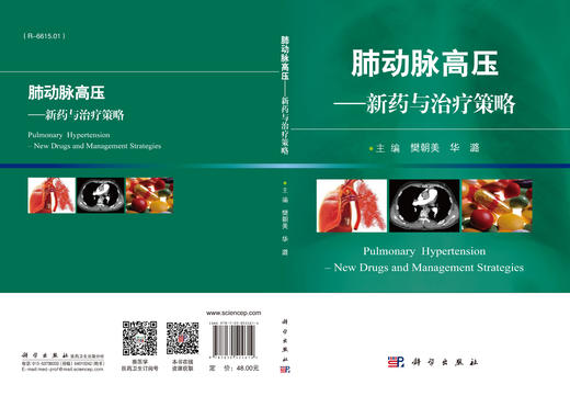 肺动脉高压 商品图3