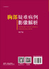 胸部疑难病例影像解析（第二版）张嵩/科学出版社 商品缩略图1