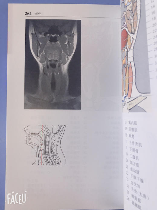 CT与MRI袖珍解剖断层图谱第一卷头颈部 医学影像诊断学 头影测量ct读片ct诊断临床 脑部血管造影术天津科技翻译出版社 商品图3