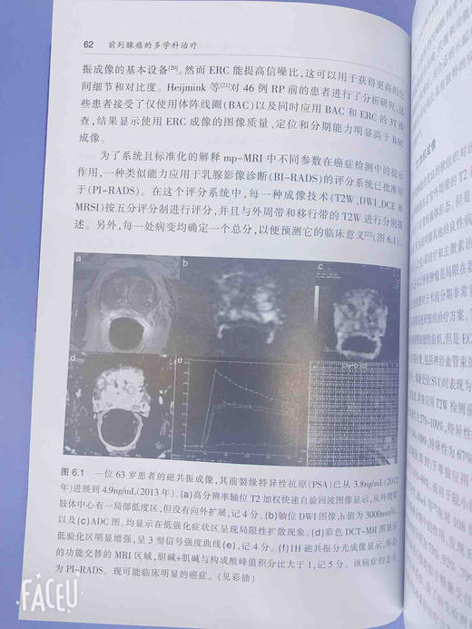 前列腺癌的多学科治疗 商品图6