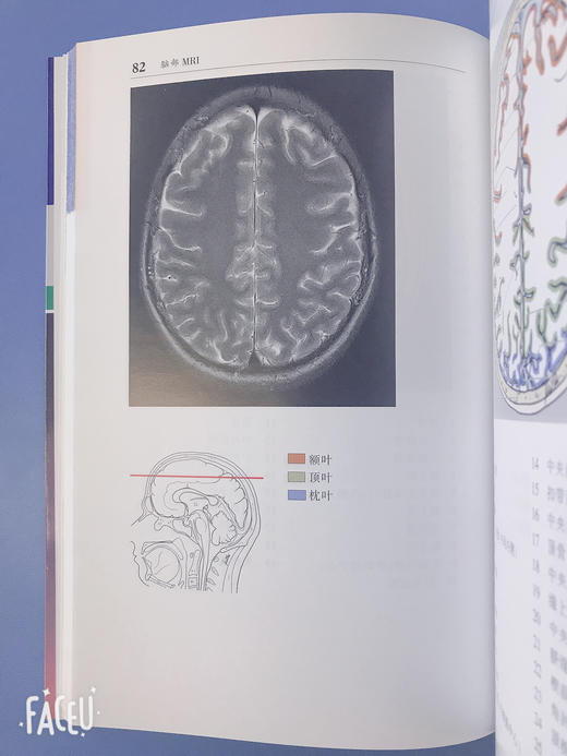 CT与MRI袖珍解剖断层图谱第一卷头颈部 医学影像诊断学 头影测量ct读片ct诊断临床 脑部血管造影术天津科技翻译出版社 商品图5