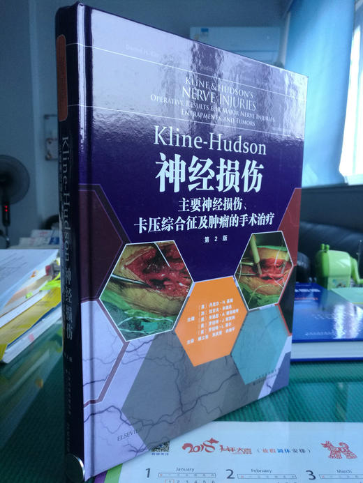 Kline-Hudson神经损伤 商品图0