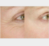 【眼霜】眼霜抗皱 蜂胶滋养紧致 去皱 去黑眼圈 祛皱 眼部护理 商品缩略图1