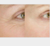【眼霜】眼霜抗皱 蜂胶滋养紧致 去皱 去黑眼圈 祛皱 眼部护理 商品缩略图3